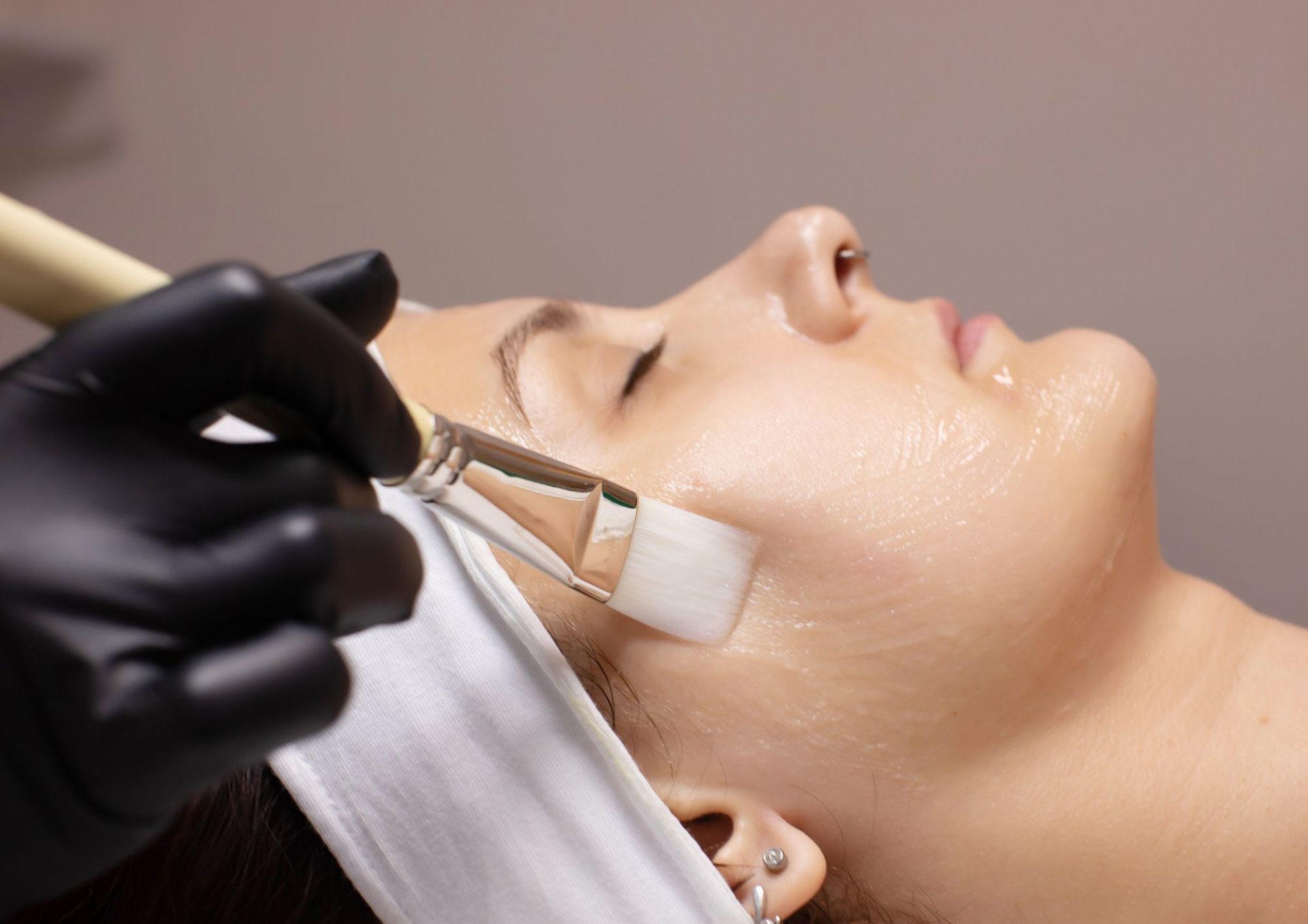Chemical Peel Treatment Benefits for Glowing Skin