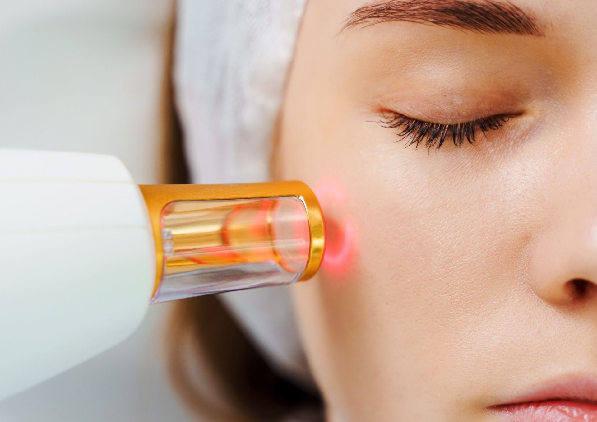Pico Laser Treatment vs. Traditional Laser