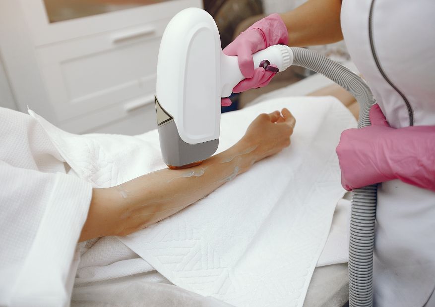 ipl hair removal