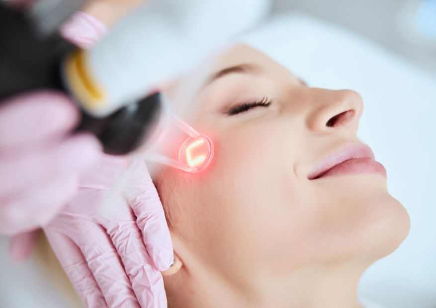pico laser treatment