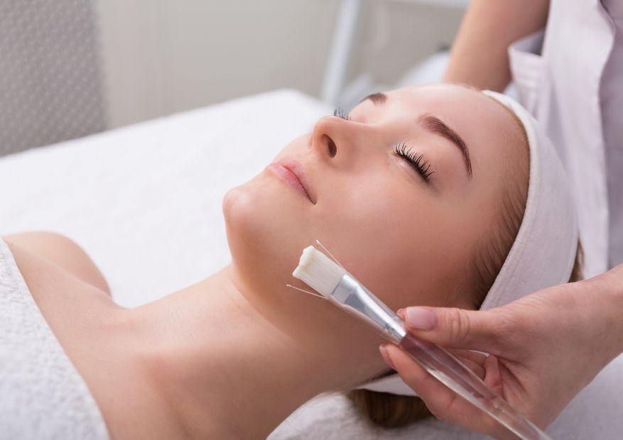 chemical peel treatment