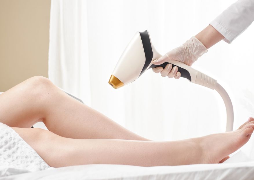 permanent hair removal