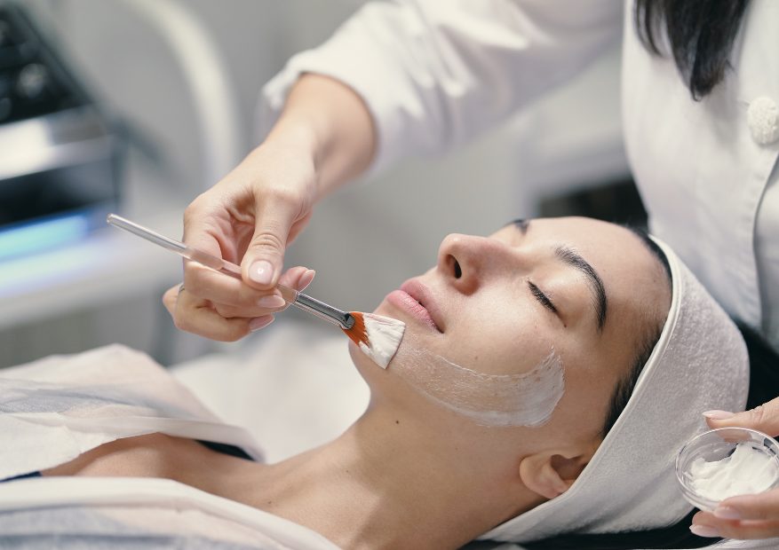 chemical peel treatment