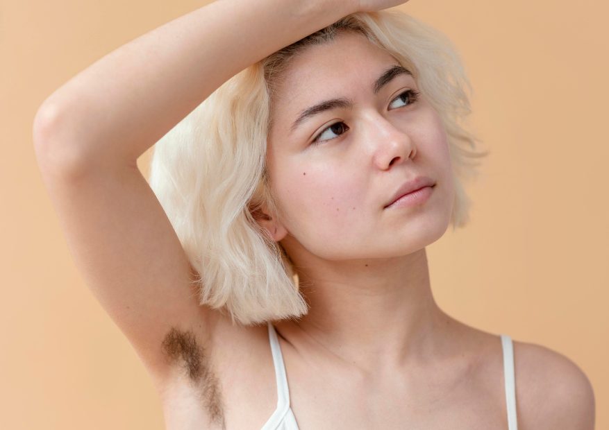 laser hair removal near me